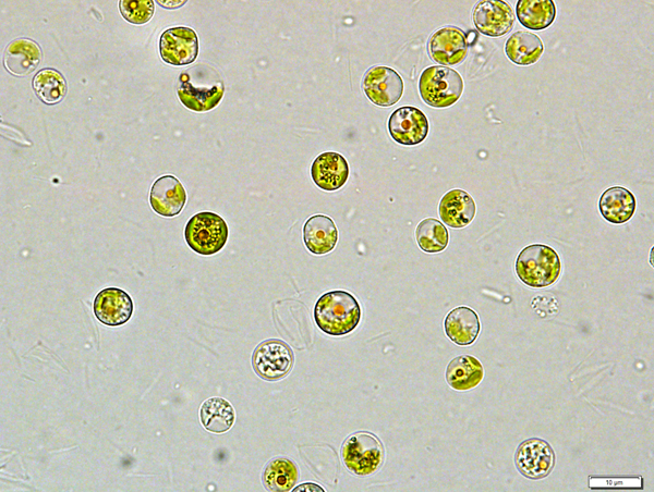 Eustigmatofytní řasa Trachydiscus minutus, foto: Tereza Ševčíková