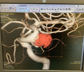 Studenti si vyzkoušeli pomocí simulátoru zákroky uvnitř cévy