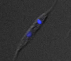 Vědci Ostravské univerzity objevili unikátní protein uvnitř prvoka